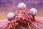   Трансплантирани имунни клетки се борят успешно с рака