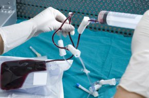 Хирурзи в Оксфорд присадиха за първи път матка във Великобритания. Приемник е 34-годишна жена, а донор е нейната 40-годишна сестра, пожелали анонимност.