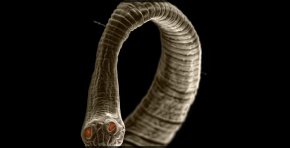  Ужасяващи снимки показват опасните червеи