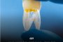 регенериране на човешки зъби