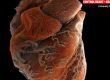 Видео разкри разликата между здраво сърце и на пациент със сърдечносъдово заболяване